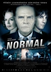  / Normal
