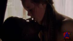  / Skins (4 )