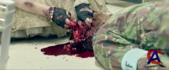   / In the Flesh (1 )